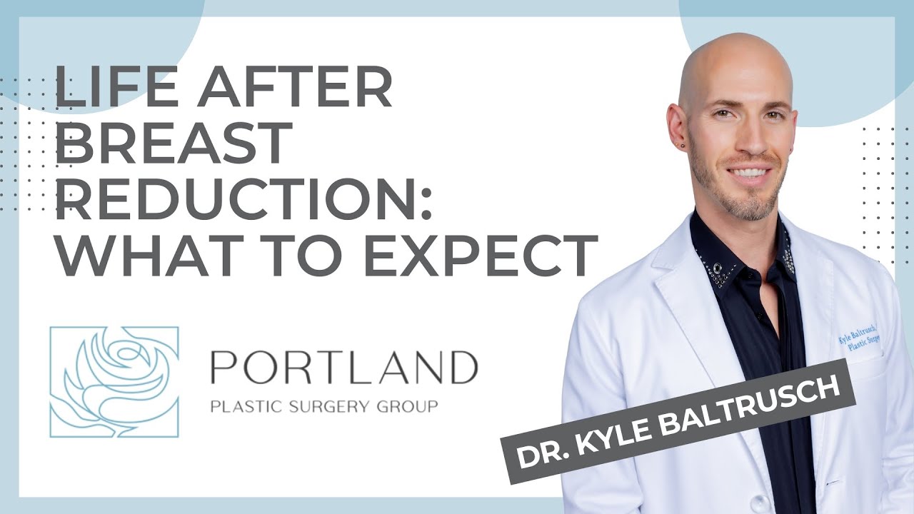 Life After Breast Reduction: What to Expect - YouTube