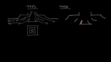 Titus Timeout Podcast - The TMS vs the TMSA