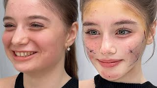 𝓕acial 𝓡econstruction 💉- by Dr. 𝓐ilee 👩🏻‍⚕️revamped ver!!
