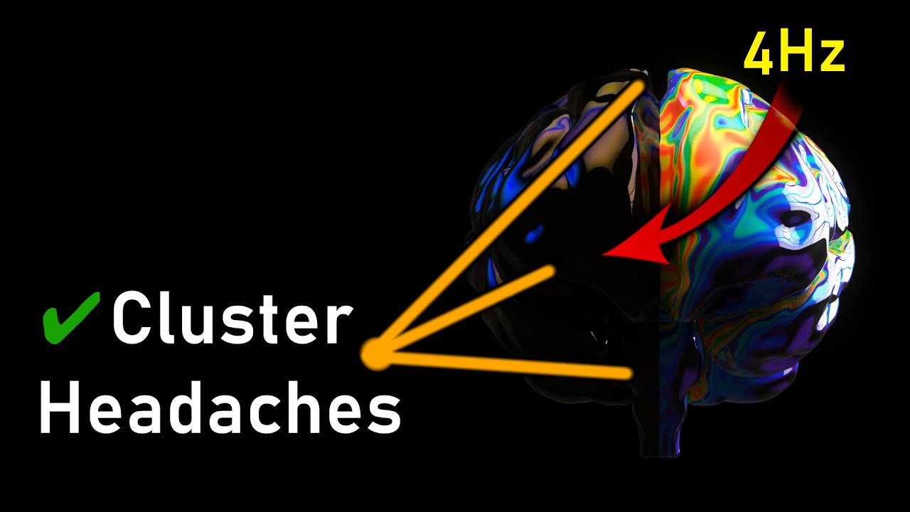 IT S HERE The Cluster Headache MIRACLE Cure Treatment Frequency it-s-here-the-cluster-headache-miracle-cure-treatment-frequency