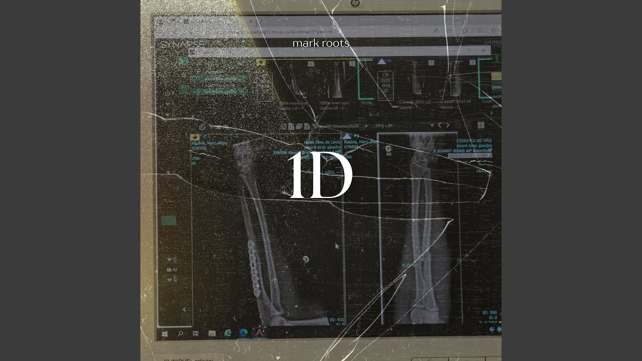 Watch 1D on YouTube Watch 1D on YouTube