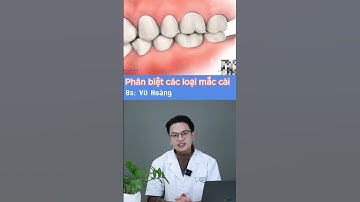 Phân biệt các loại mắc cài | Nha Khoa Minh Châu