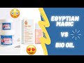 Bio oil  egyptian magic   pour se dbarrasser des vergetures 