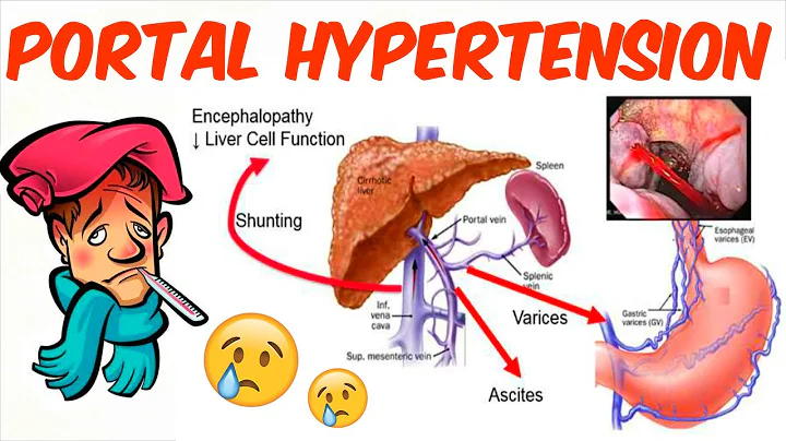 Portal Hypertension - DayDayNews