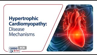 Hypertrophic Cardiomyopathy: Disease Mechanisms