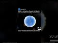 Near-Frictionless Droplet Motion Breakthrough | Pico-Nanofluidics #diagnosis #medical #tech #shorts