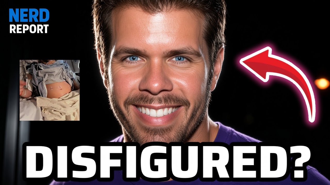 PEREZ HILTON SHOCKING UPDATE After Livestream Incident — Possible Permanent Disfigurement!?