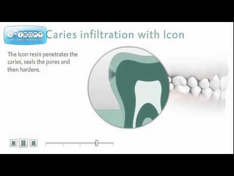 ვბურღავთ? არა გმადლობთ