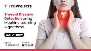 Thyroid Disease Detection using Machine Learning Algorithms