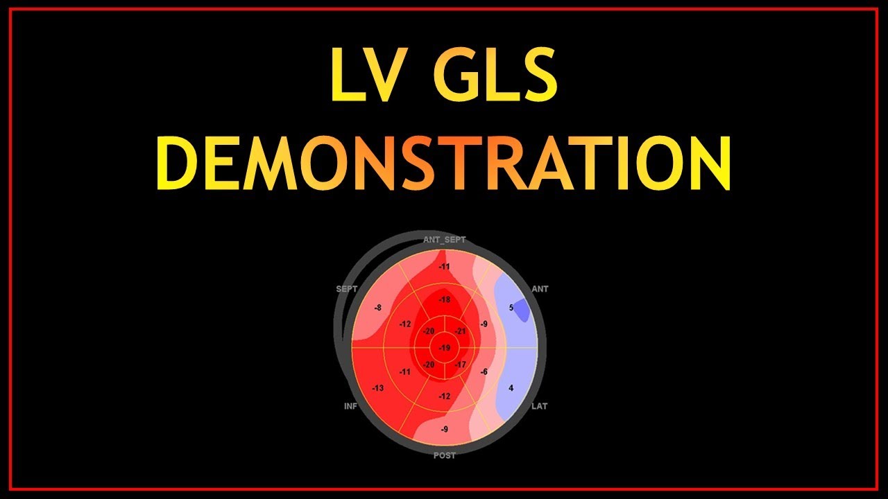 GLS Practical Demonstration! (PART 2) 