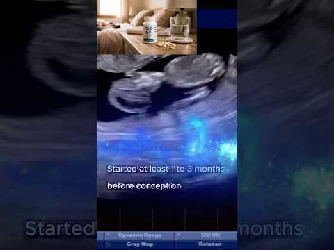 Anencephaly - Tips for Future Prevention Planning