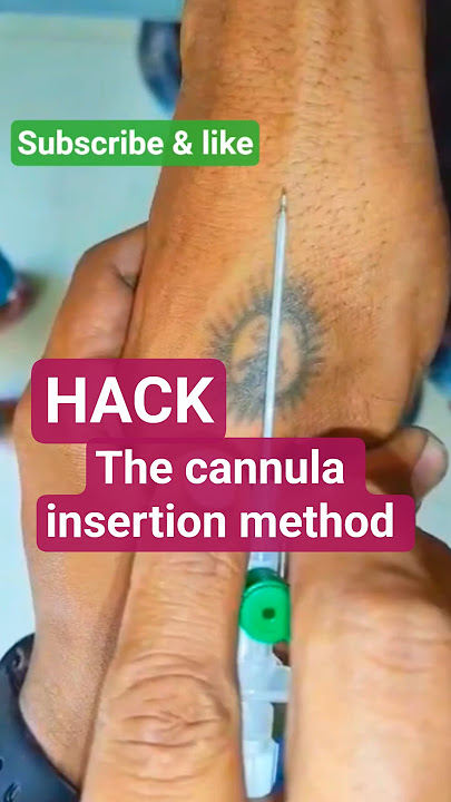 Why Doctors Hate This 18G Cannula Trick ! #MedicalHack ##DoctorSecrets #NurseLife #shorts #meded