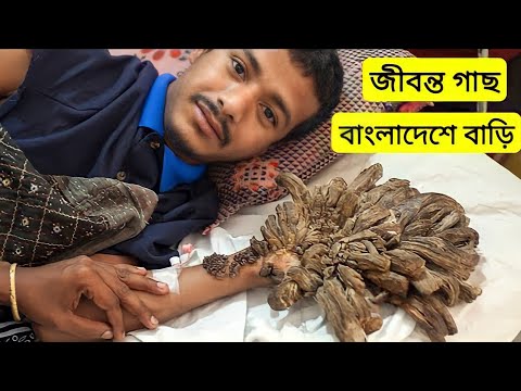 ভিডিও: আমরা পুরো স্বাস্থ্য মন্ত্রণালয়ের চেয়ে কারাগারের ব্যবস্থায় বেশি ব্যয় করি