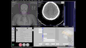 CT Cerebral Angio Full Work Process (SIEMENS) in syngo acquisition workplace