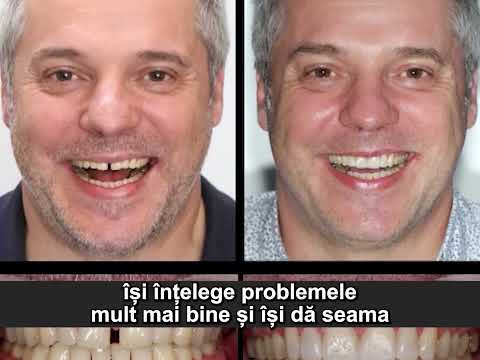Digital Smile Design.