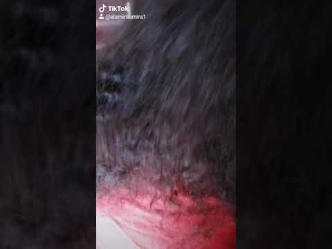 فرد اعشاب مانع لتقصيف الشعر ونزوله