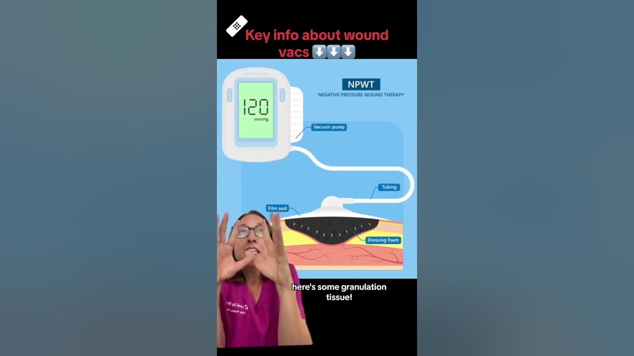 Wound Vacs Wound Care SHORT LevelUpRN YouTube