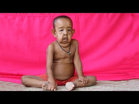 Video: A Four Year Old Boy From Bangladesh Looks Like An Old Man - Alternative View