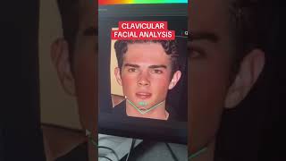 How Attractive Is Clavicular REALLY? #clavicular #facerating #facialanalysis #qoves Profile