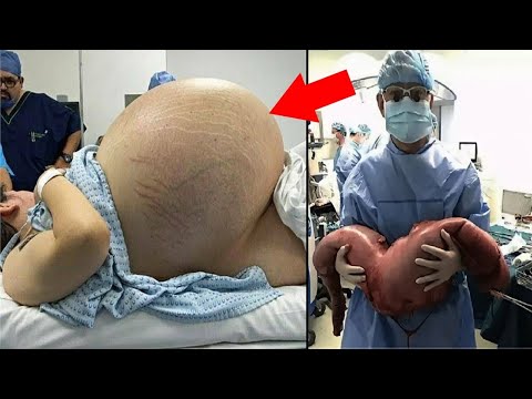 Vídeo: 10 Casos Médicos Incríveis - Visão Alternativa