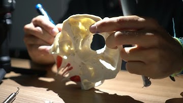 Full Arch Immediate Loading Course with Dr. Bernardo Sousa in Tirana, Albania