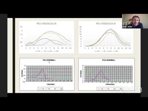 Video: Coerenza Anormale E Composizione Del Sonno Nei Bambini Con Sindrome Di Angelman: Uno Studio Retrospettivo EEG