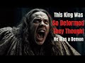 This King Was So Deformed They Thought He Was a Demon