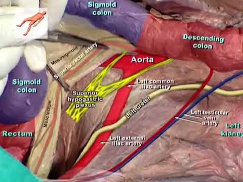 open Mesorectal  excision tips