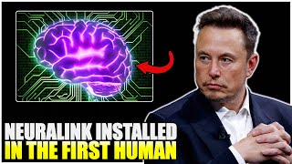 Neuralink Was Implanted In The First Human