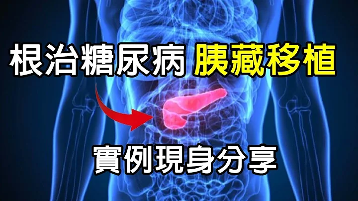 唯一治癒糖尿病辦法:【胰臟移植】，37歲做胰臟器官移植，完全擺脫掉胰島素與測血糖，個案親自分享他的實際經驗 - 天天要聞