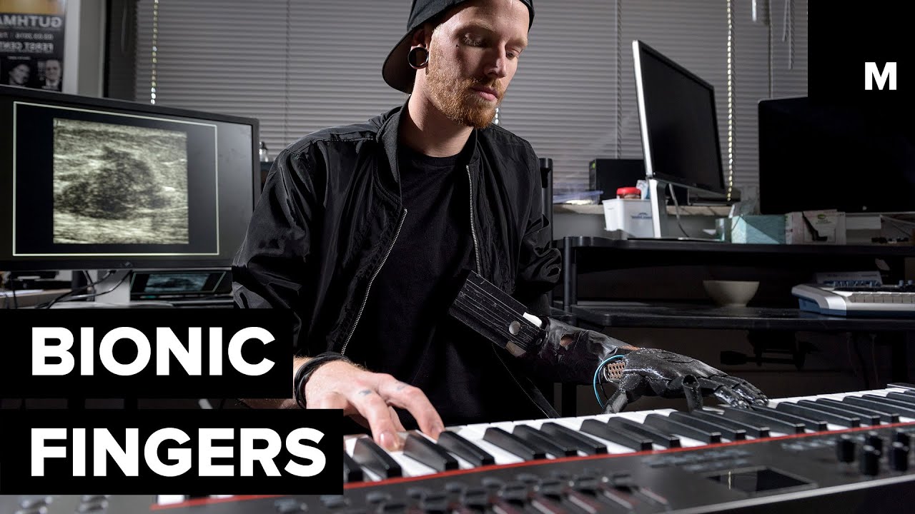 Man Strums Star Wars Theme Song With Bionic Hand - YouTube