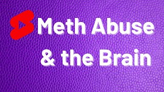 Meth Abuse & the Brain