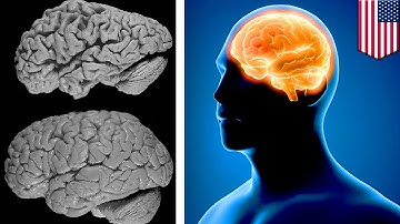 Memory loss in Alzheimer