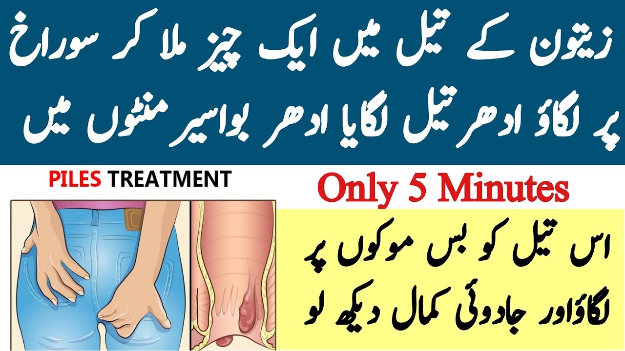 Bawaseer Ka Asan Elaj Piles Treatments Home Remedies Bawaseer Ka