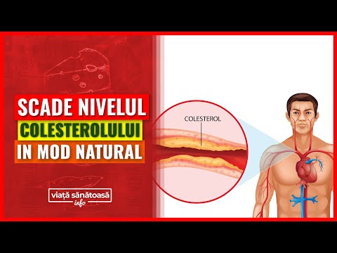 Video: 5 Moduri Simple De A Reduce Colesterolul Rău