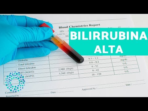 Bilirrubina ALTA: Sintomas e TRATAMENTOS NATURAIS