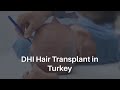 Dhi hair transplant in turkey  dhi hair transplant cost in turkey