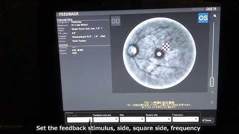 Nidek MP-3 - Reabilitação Visual