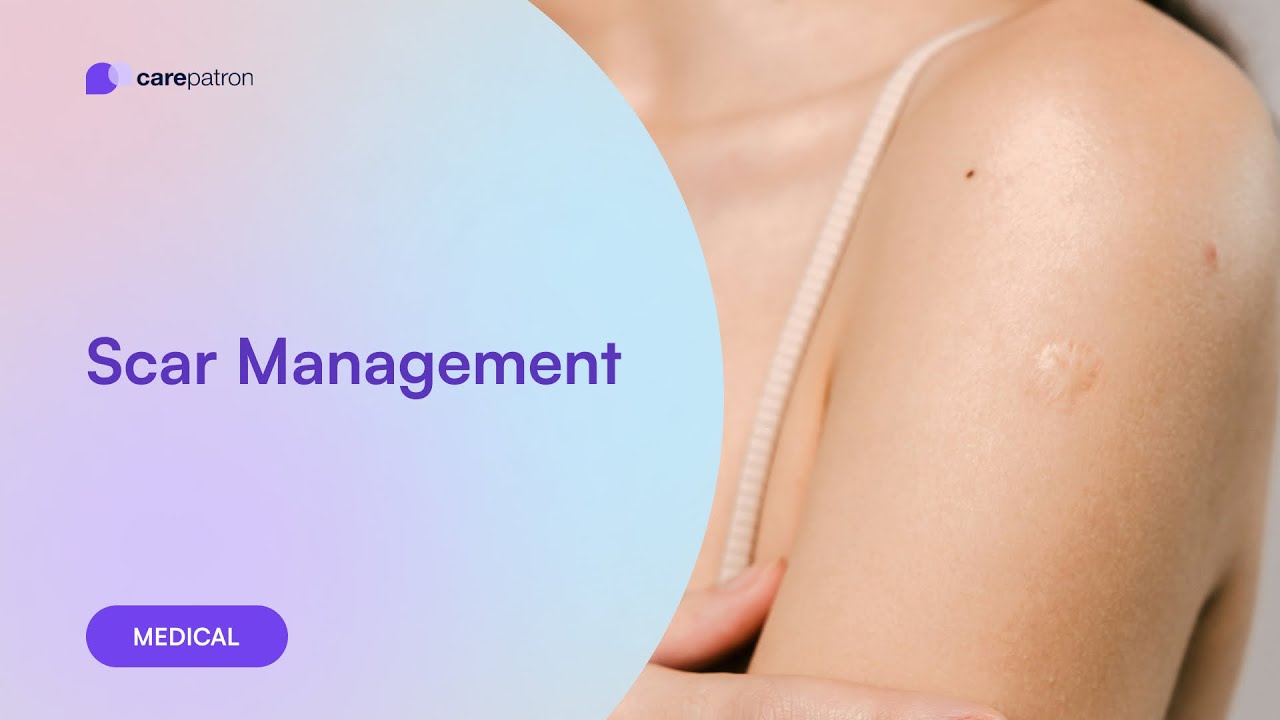 Scar Management Program Scar Management - YouTube