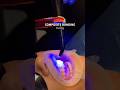 Composite Bonding Before, During & After | Real Smile Transformation | UK Dentist #compositebonding