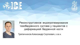 видео: Реконструктивное эндопротезирование тазобедренного сустава у пациентов с деформацией бедренной кости картинка: Реконструктивное эндопротезирование тазобедренного сустава у пациентов с деформацией бедренной кости