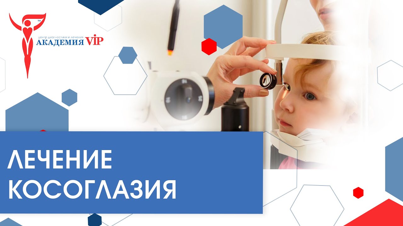 Как лечить косоглазие - YouTube