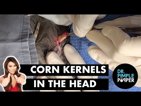 Corn Kernels in the Head