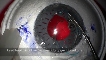 Yamane IOL Scleral Fixation Technique Demo on SimulEye Model