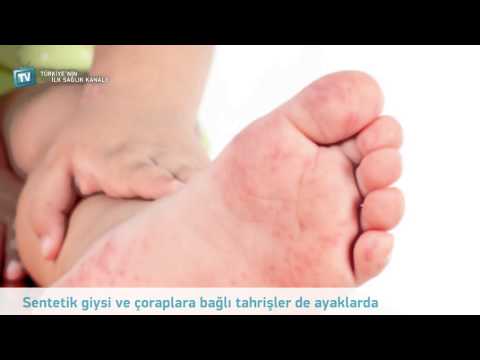 Mantar Nedir?