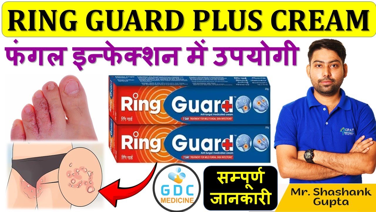 Ring guard cream review 😍Ring guard cream uses in hindi | ring guard cream ke fayde 