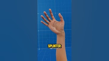 Don’t Use Tweezers for Splinters Try This Instead!😁