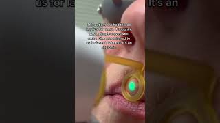 Treating Spot On Face With Laser