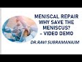 Meniscal repair why save the meniscus demo