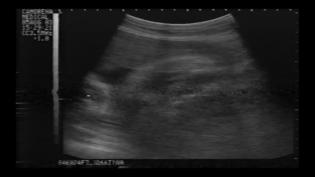 Desi Ultrasound